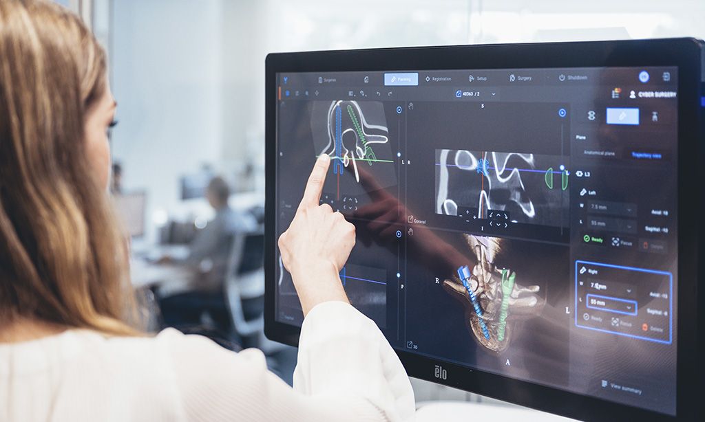 Surai proiektua | Argazkia: Cyber Surgery Surai proiektua | Argazkia: Cyber Surgery